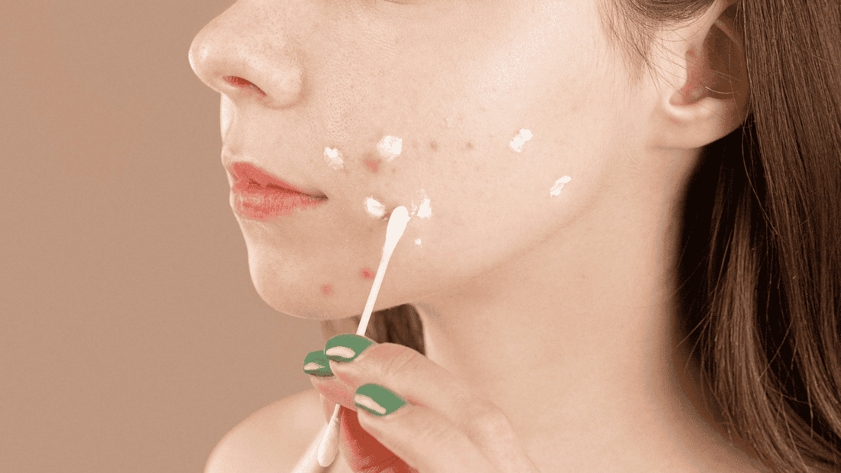 Mujer aplica crema en grano